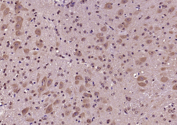 KLK9 Rabbit Polyclonal Antibody