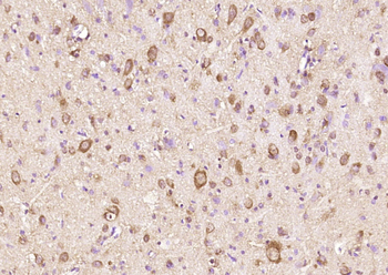 TNNI3K Rabbit Polyclonal Antibody