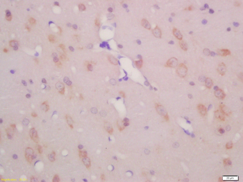 KCNC3 Rabbit Polyclonal Antibody