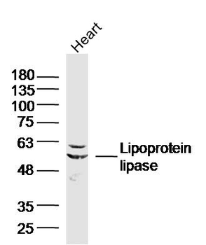 Lipoprotein lipase Rabbit Polyclonal Antibody