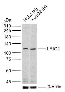LRIG2 Rabbit Polyclonal Antibody