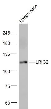 LRIG2 Rabbit Polyclonal Antibody