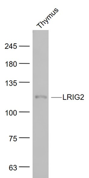 LRIG2 Rabbit Polyclonal Antibody
