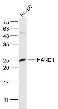 HAND1 Rabbit Polyclonal Antibody