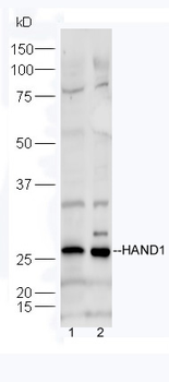 HAND1 Rabbit Polyclonal Antibody