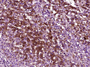 MASP2 Rabbit Polyclonal Antibody