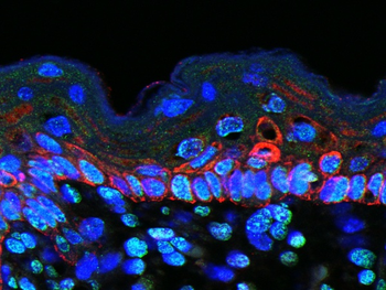 Macrophage Inflammatory Protein 1 gamma Rabbit Polyclonal Antibody