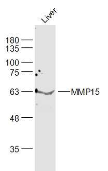 MMP15 Rabbit Polyclonal Antibody