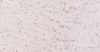 MMP12 Rabbit Polyclonal Antibody