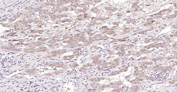 MMP12 Rabbit Polyclonal Antibody