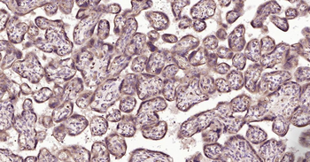 MMP12 Rabbit Polyclonal Antibody