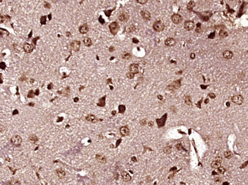 Alpha MSH Rabbit Polyclonal Antibody