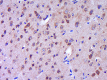 HOPX/LAGY Rabbit Polyclonal Antibody