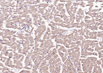 MuRF1 Rabbit Polyclonal Antibody