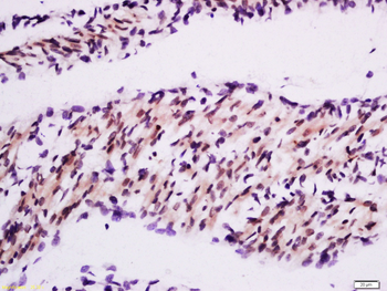 MuRF1 Rabbit Polyclonal Antibody