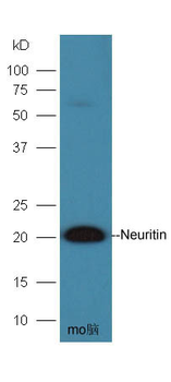 Neuritin Rabbit Polyclonal Antibody