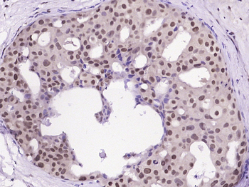 Glutamate receptor 3 Rabbit Polyclonal Antibody