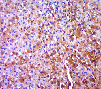 Netrin 1 Rabbit Polyclonal Antibody
