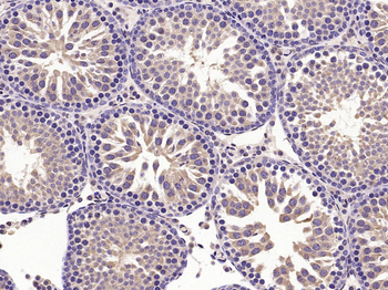 DNAJC3 Rabbit Polyclonal Antibody