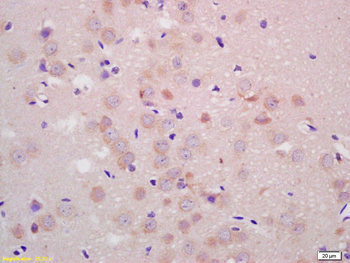 Parkin Rabbit Polyclonal Antibody