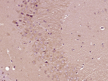 FSCN1 Rabbit Polyclonal Antibody