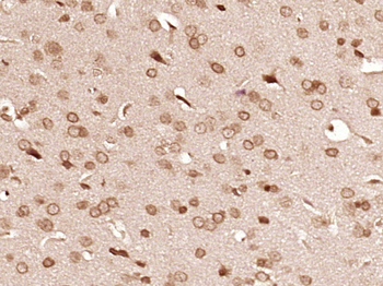 PRCP Rabbit Polyclonal Antibody