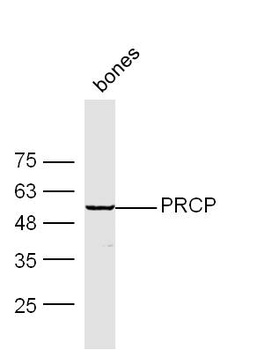 PRCP Rabbit Polyclonal Antibody