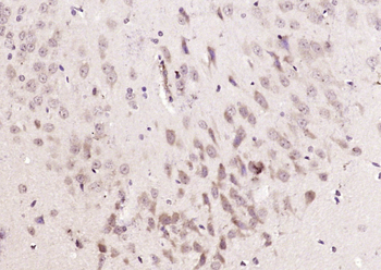 HIF Prolyl Hydroxylases Rabbit Polyclonal Antibody