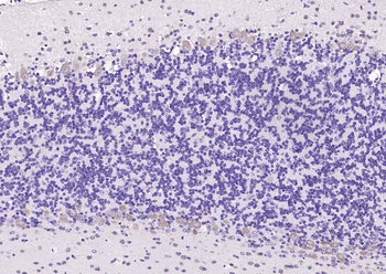 Pleiotrophin Rabbit Polyclonal Antibody