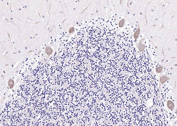 Pleiotrophin Rabbit Polyclonal Antibody