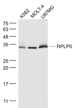 RPLP0 Rabbit Polyclonal Antibody