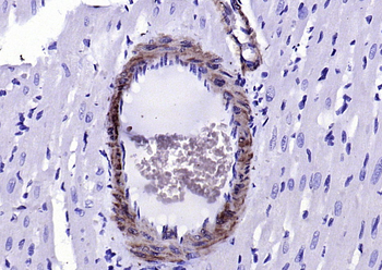 SM22 Alpha Rabbit Polyclonal Antibody