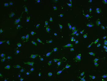 SM22 Alpha Rabbit Polyclonal Antibody