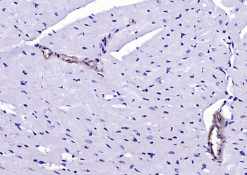 SM22 Alpha Rabbit Polyclonal Antibody