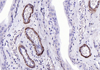 SM22 Alpha Rabbit Polyclonal Antibody