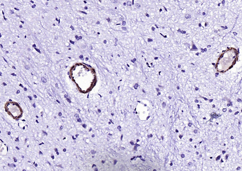 SM22 Alpha Rabbit Polyclonal Antibody