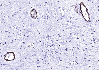SM22 Alpha Rabbit Polyclonal Antibody