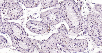 SPATA12 Rabbit Polyclonal Antibody