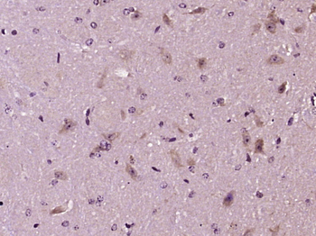 TGM3 Rabbit Polyclonal Antibody