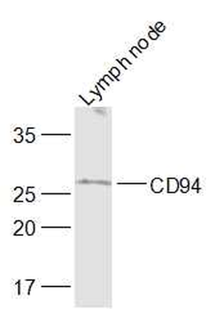 CD94 Rabbit Polyclonal Antibody