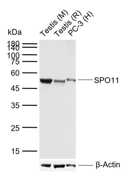 SPO11 Rabbit Polyclonal Antibody