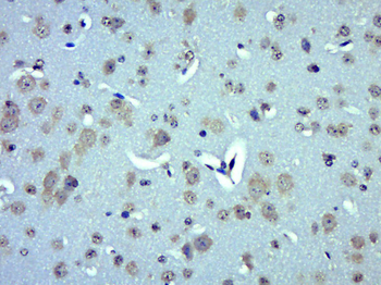 UCP-2 Rabbit Polyclonal Antibody