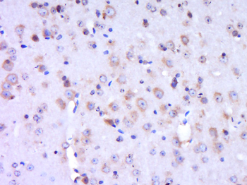 WRCH1 Rabbit Polyclonal Antibody