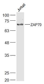 ZAP70 Rabbit Polyclonal Antibody