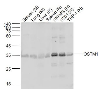 OSTM1 Rabbit Polyclonal Antibody
