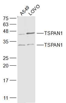 TSPAN1 Rabbit Polyclonal Antibody