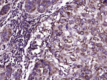 KATNA1 Rabbit Polyclonal Antibody