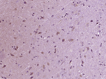 KATNA1 Rabbit Polyclonal Antibody