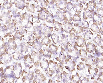 KATNA1 Rabbit Polyclonal Antibody