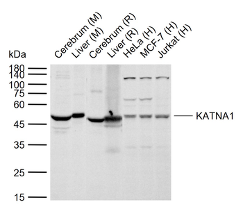 KATNA1 Rabbit Polyclonal Antibody
